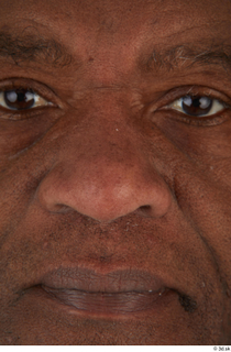 Photos of Jafaris Simon nose 0001.jpg